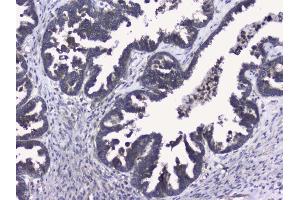 IHC analysis of RALBP1 using anti-RALBP1 antibody (ABIN5692936).