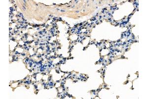 ABIN7094559 and ABIN7098608 at 1/100 staining Mouse lung tissue by IHC-P.