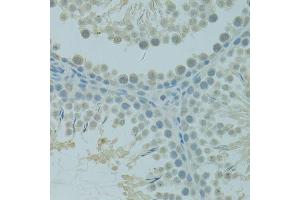 Immunohistochemistry of paraffin-embedded rat testis using CTAG1B antibody (ABIN6003542) at dilution of 1/100 (40x lens). (CTAG1B antibody)