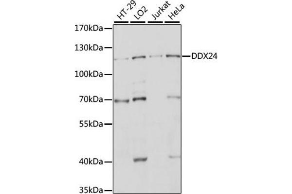 DDX24 antibody  (AA 510-859)