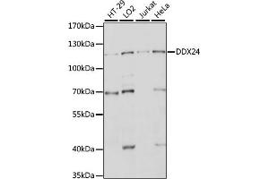 Western blot analysis of extracts of various cell lines, using DDX24 antibody (ABIN7266691) at 1:1000 dilution. (DDX24 antibody  (AA 510-859))
