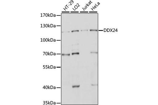DDX24 抗体  (AA 510-859)