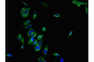 Immunofluorescent analysis of Hela cells using ABIN7145942 at dilution of 1:100 and Alexa Fluor 488-congugated AffiniPure Goat Anti-Rabbit IgG(H+L) (CCR7 antibody  (AA 332-378))