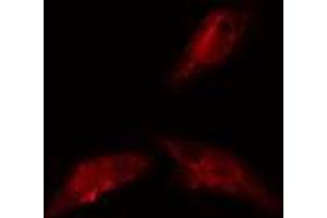 ABIN6278585 staining  293 cells by IF/ICC. (KIF20A antibody  (C-Term))