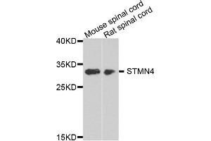Western blot analysis of extract of mouse spinal cord and rat spinal cord cells, using STMN4 antibody. (STMN4 antibody)