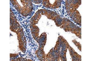 Immunohistochemistry (IHC) image for anti-Cullin 4A (CUL4A) antibody (ABIN1872121) (Cullin 4A antibody)