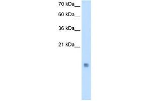 CSTB antibody - middle region  validated by WB using Transfected 293T cell lysate at 0. (CSTB antibody  (Middle Region))