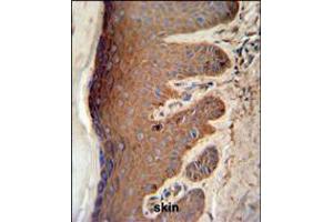 PKM2 Antibody (C-term L398) IHC analysis in formalin fixed and paraffin embedded skin tissue followed by peroxidase conjugation of the secondary antibody and DAB staining. (PKM2 antibody  (C-Term))
