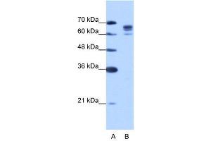 WB Suggested Anti-DDX17  Antibody Titration: 1.