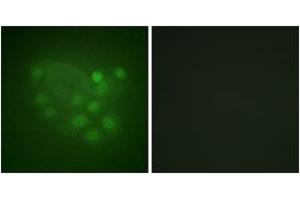 Immunofluorescence analysis of A549 cells, using KIF2C (Ab-95) Antibody. (KIF2C antibody  (AA 61-110))