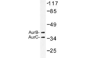 Image no. 1 for anti-Aurora Kinase B (AURKB) antibody (ABIN272126) (Aurora Kinase B antibody)