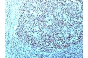 Immunohistochemistry (IHC) image for anti-Nucleolin (NCL) antibody (ABIN3025715)