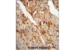 MYOZ1 Antibody (Center) (ABIN651441 and ABIN2840243) immunohistochemistry analysis in formalin fixed and paraffin embedded mouse heart tissue followed by peroxidase conjugation of the secondary antibody and DAB staining. (Myozenin 1 antibody  (AA 40-69))
