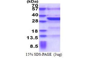 BTB (POZ) Domain-Containing Protein KCTD4 (KCTD4) (AA 1-259) protein (His tag)