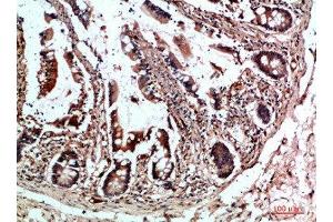Immunohistochemical analysis of paraffin-embedded human-colon, antibody was diluted at 1:200 (CYFIP2 antibody  (AA 1171-1220))