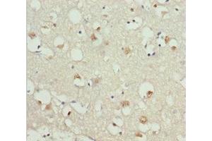 Immunohistochemistry of paraffin-embedded human brain tissue using ABIN7154698 at dilution of 1:100 (GNAO1 antibody  (AA 60-180))