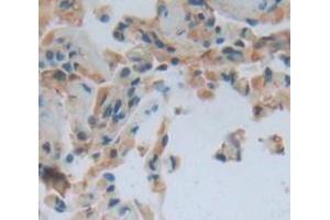 Figure. (TOR2A antibody  (AA 49-248))