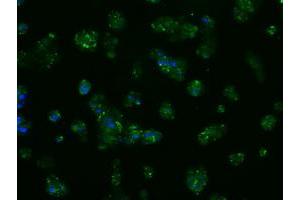 Image no. 10 for anti-Amyloid beta (A4) Precursor Protein (APP) antibody (ABIN1496877) (APP antibody)