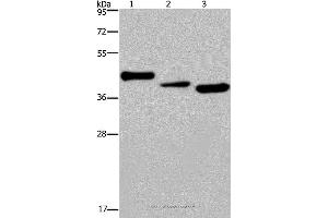 Western blot analysis of Mouse heart tissue, A549 and HepG2 cell, using CYR61 Polyclonal Antibody at dilution of 1:300 (CYR61 antibody)