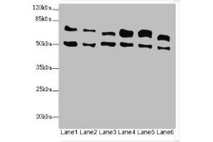 Western blot All lanes: ELF2 antibody at 3. (ELF2 antibody  (AA 1-140))