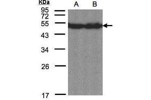 WB Image Sample(30 μg of whole cell lysate) A:Hep G2, B:MOLT4 , 12% SDS PAGE antibody diluted at 1:1500