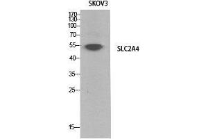Western Blot (WB) analysis of SKOV3 cells using Glut4 Polyclonal Antibody. (GLUT4 antibody  (Internal Region))