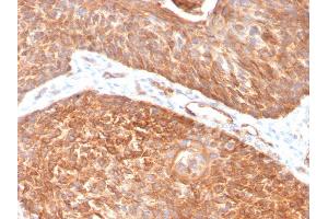 Formalin-fixed, paraffin-embedded human Pancreas stained with Cytokeratin 5 Mouse Monoclonal Antibody (KRT5/3594). (Cytokeratin 5 antibody  (AA 316-590))