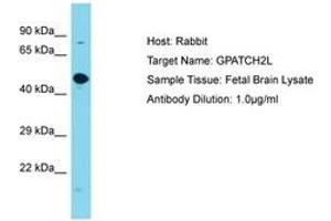 Image no. 1 for anti-G Patch Domain Containing 2-Like (GPATCH2L) (AA 169-218) antibody (ABIN6750637) (GPATCH2L antibody  (AA 169-218))