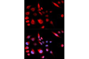Immunofluorescence (IF) image for anti-Kinesin Family Member 2C (KIF2C) antibody (ABIN1876637) (KIF2C antibody)