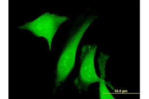 Immunofluorescence of purified MaxPab antibody to CALU on HeLa cell. (CALU antibody  (AA 1-315))