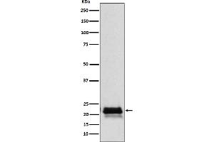 Western blot analysis of FSH beta (FSHB) expression in Human pituitary lysate.