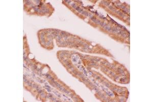 Anti-NFkB p100 Picoband antibody,  IHC(P): Mouse Intestine Tissue (NFKB2 antibody  (AA 1-340))