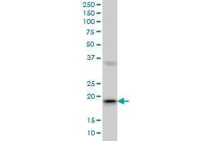 RBBP9 monoclonal antibody (M01A), clone 2A11 Western Blot analysis of RBBP9 expression in MCF-7 . (RBBP9 antibody  (AA 87-185))