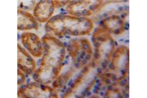Used in DAB staining on fromalin fixed paraffin-embedded Kidney tissue (PDGF-AA Homodimer (AA 90-190) antibody)