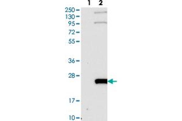 WW Domain Binding Protein 5 (WBP5) antibody