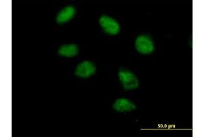 Immunofluorescence of purified MaxPab antibody to PAXIP1 on HeLa cell. (PAXIP1 antibody  (AA 1-757))