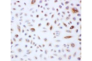 Peroxiredoxin 3 antibody and A549 cells tested by ICC (Peroxiredoxin 3 antibody  (AA 239-256))