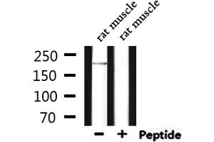 Western blot analysis of extracts from rat muscle, using DOCK7 Antibody. (DOCK7 antibody  (N-Term))
