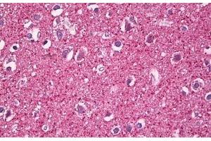 Anti-MZF1 antibody IHC staining of human brain, cortex neuropil. (MZF1 antibody  (AA 1-50))