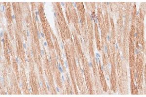 Immunohistochemistry of paraffin-embedded Mouse heart using GRK5 Polyclonal Antibody at dilution of 1:100 (40x lens). (GRK5 antibody)