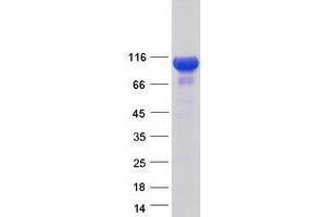 Validation with Western Blot