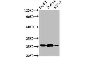Western Blot  Positive WB detected in:HepG2 whole cell lysate,Jurkat whole cell lysate,MCF-7 whole cell lysate  All lanes:BCL2 antibody at 1μg/ml  Secondary  Goat polyclonal to rabbit IgG at 1/50000 dilution  Predicted band size: 26 KDa  Observed band size: 26 KDa (Recombinant Bcl-2 antibody)