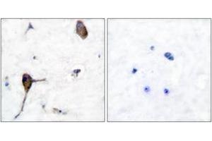Immunohistochemistry analysis of paraffin-embedded human brain tissue, using IL-3R beta (Ab-593) Antibody. (CSF2RB2 antibody  (AA 559-608))