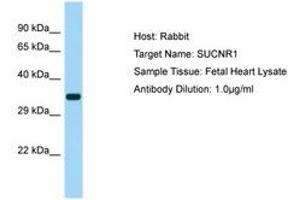 Image no. 1 for anti-Succinate Receptor 1 (SUCNR1) (AA 161-210) antibody (ABIN6750142) (SUCNR1 antibody  (AA 161-210))