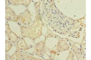 Immunohistochemistry of paraffin-embedded human kidney tissue using ABIN7164457 at dilution of 1:100 (GPR146 antibody  (AA 301-333))