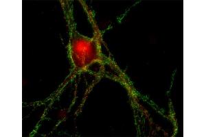 Immunocytochemistry (ICC) image for anti-gamma-aminobutyric Acid (GABA) A Receptor, beta 2 (GABRB2) (AA 343-430) antibody (ABIN1742467)