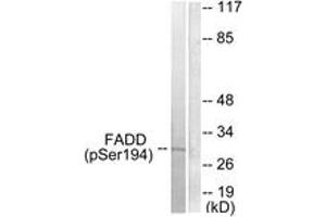 Western blot analysis of extracts from HeLa cells treated with Paclitaxel 1uM 60', using FADD (Phospho-Ser194) Antibody. (FADD antibody  (pSer194))