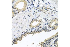 Immunohistochemistry of paraffin-embedded human prostate using STXBP2 antibody (ABIN5975753) at dilution of 1/100 (40x lens). (STXBP2 antibody)