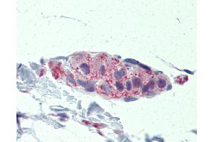 Anti-TNKS / Tankyrase antibody IHC of human small intestine, submucosal plexus. (TNKS antibody  (AA 972-1021))