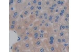 Figure. (Complement C3 Convertase antibody  (AA 1314-1663))